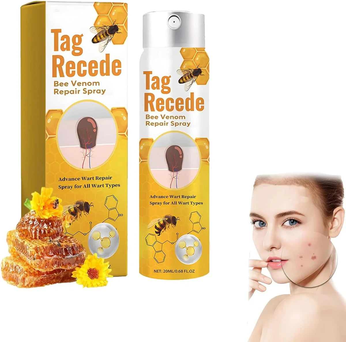 Tag Recede Bee Venom Repair Spray – Advanced Wart & Skin Tag Care
