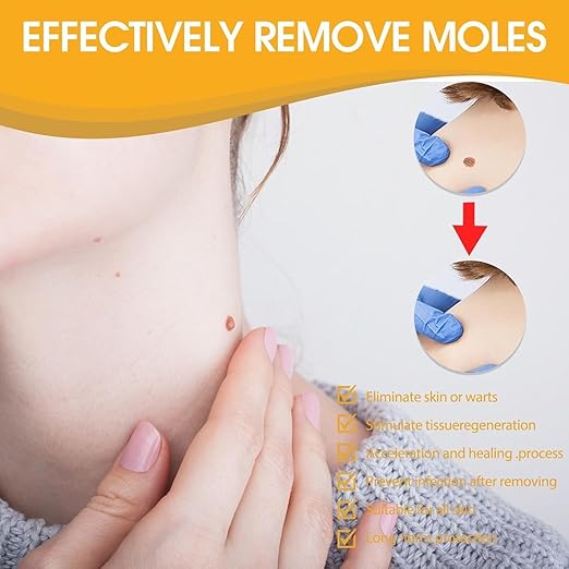 Tag Recede Bee Venom Repair Spray – Advanced Wart & Skin Tag Care